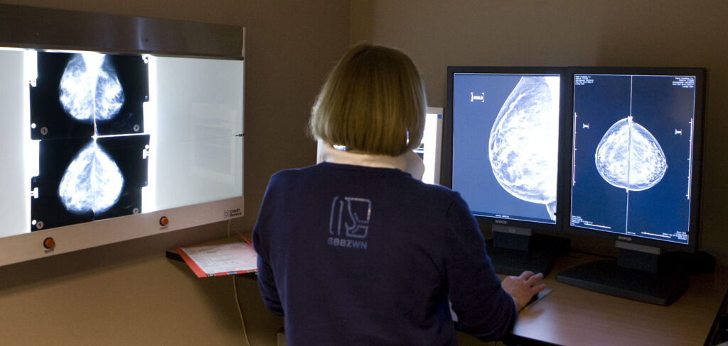 Een radioloog bekijkt digitale rontgenfoto's mammografie in de onderzoeksunit van de Stichting Bevolkingsonderzoek Borstkanker in Rotterdam.